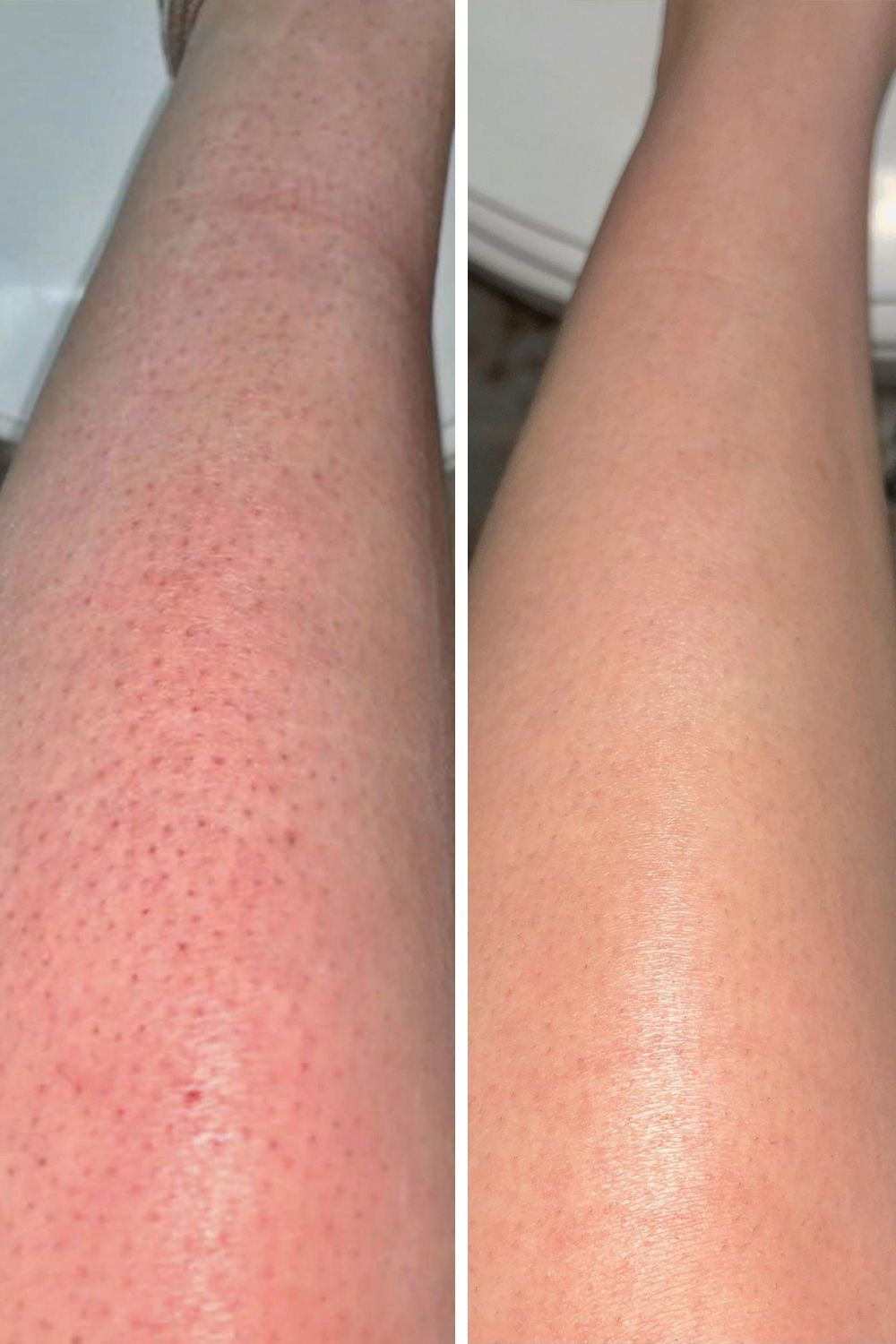 Turmeric body scrub🌱(300 Grams)